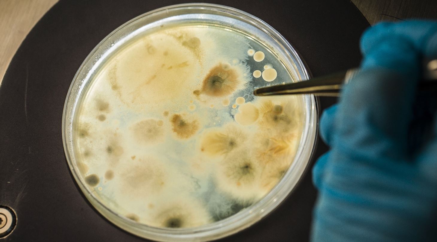 Biofilm infections